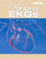 Understanding 12-Lead EKGs: A Practical Approach, 2nd Edition